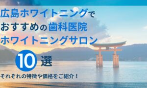広島ホワイトニングでおすすめの歯科医院ホワイトニングサロン10選
