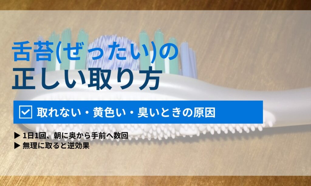 舌苔(ぜったい)の正しい取り方|取れない・黄色い・臭いときの原因と受診の目安|ORAL MEDIA