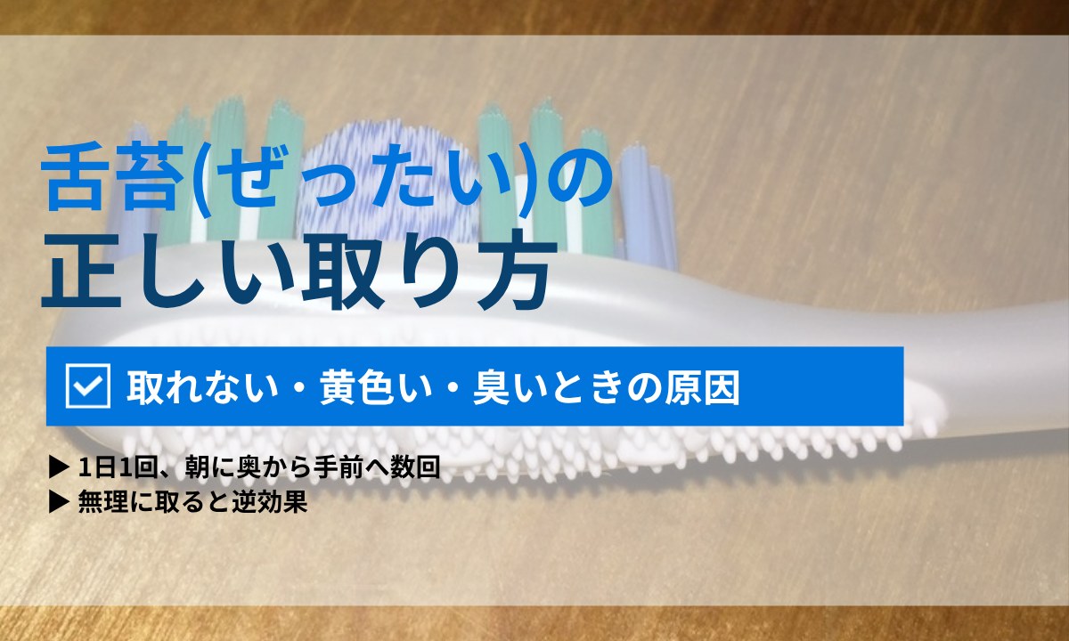 舌苔(ぜったい)の正しい取り方|取れない・黄色い・臭いときの原因と受診の目安|ORAL MEDIA