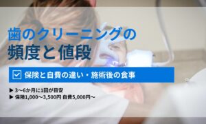 歯のクリーニングの頻度と値段｜保険適用の範囲・ホワイトニングとの違い・施術後の食事まで解説｜ORAL MEDIA
